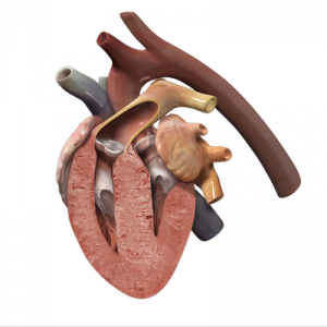 An illustration of a feline heart with hypertrophic cardiomyopathy. Notice how the thick heart muscle becomes too stiff to pump blood effectively.