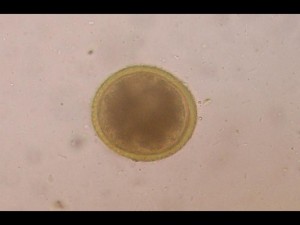 Roundworm egg as seen under the microscope.
