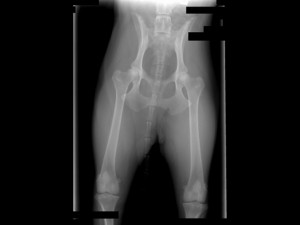 Normal hip x-rays