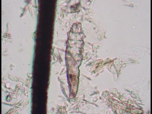 A microscopic image of a Demodex mite.