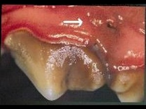 Brushing your dog’s teeth daily will prevent periodontal disease.