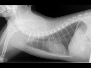 Normal Chest X-ray