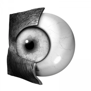 Entropion. Notice how the lower lid curls in towards the surface of the eye to cause irritation.