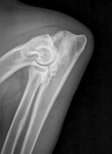 X-ray demonstrating elbow dysplasia. The red arrow points to the ununited anconeal process, a form of elbow dysplasia. This abnormal bone fragment causes joint inflammation and pain.