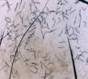 Microscopic image of numerous Demodex mites.