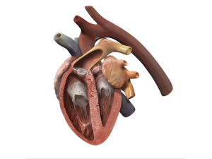 Illustration of degenerative valves in the heart. Over time, some dogs will develop heart failure.