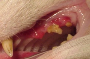 Stomatitis